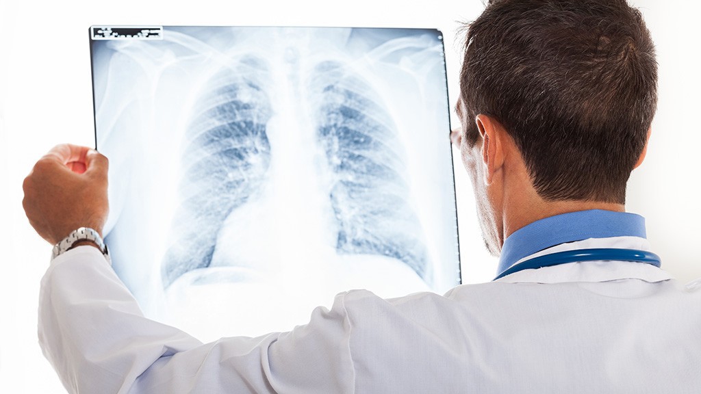 Göğüs Hastalıkları